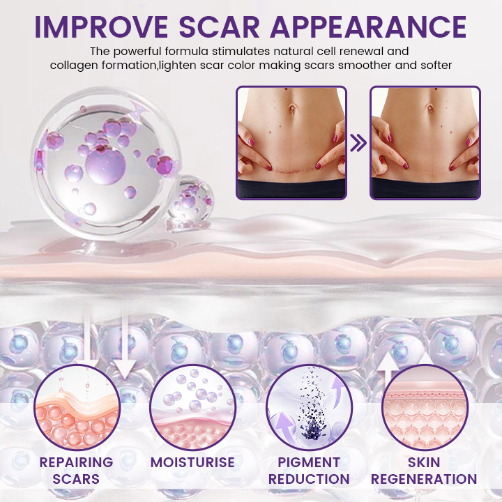 TIMILK REGENSCAR SCAR REMOVAL GEL