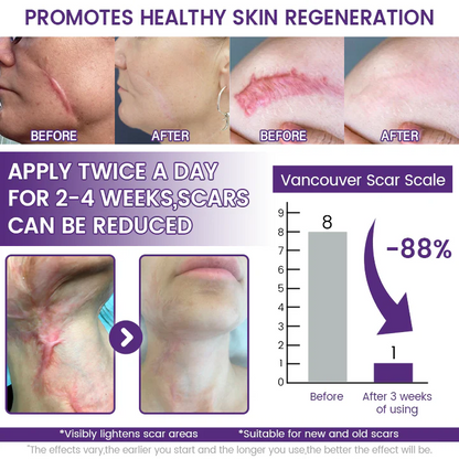 TIMILK REGENSCAR SCAR REMOVAL GEL